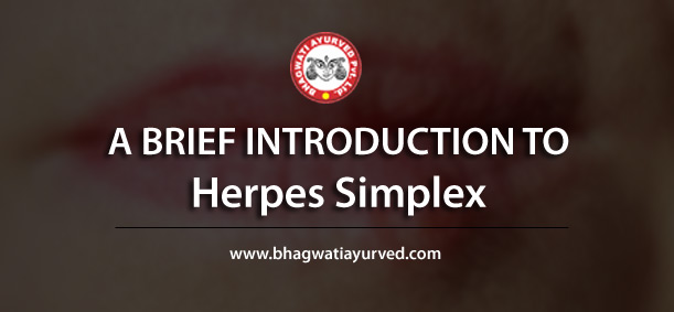 A Brief Introduction to Herpes Simplex